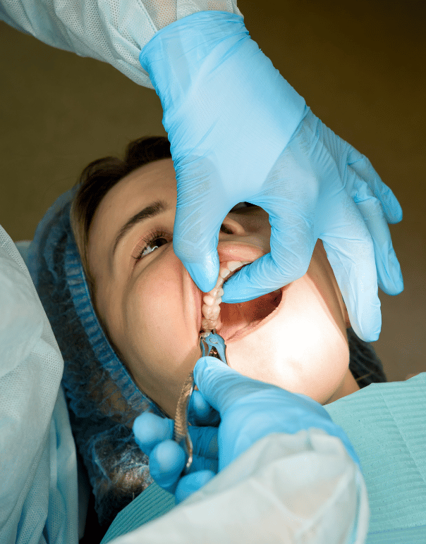 Tooth Extraction